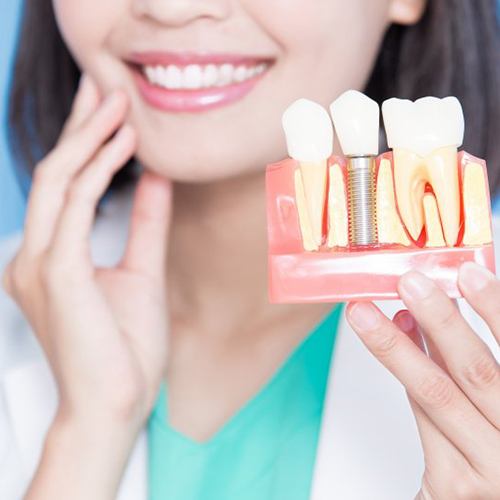 a person holding a model of a dental implant